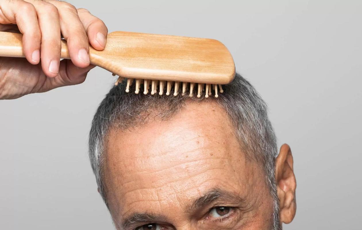Voici 5 aliments qui permettraient de ralentir l'apparition des cheveux blancs