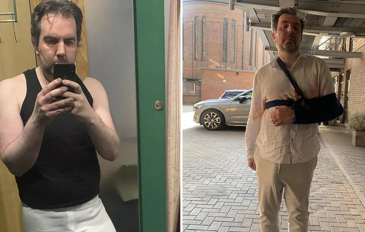 L'homme avec le plus gros pénis du monde grièvement blessé dans un accident causé par ses organes génitaux