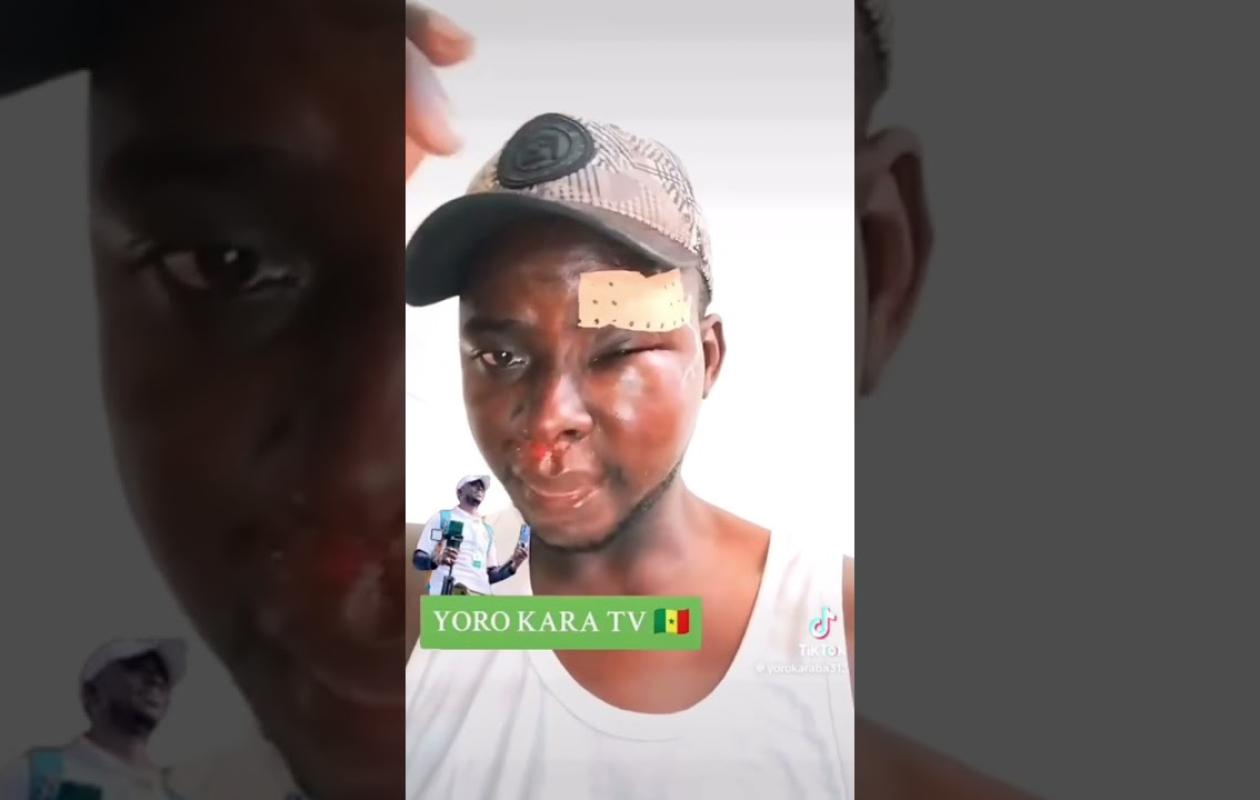 L’influenceur républicain Yoro Kara victime d’une tentative d’assassinat sur la route de Touba