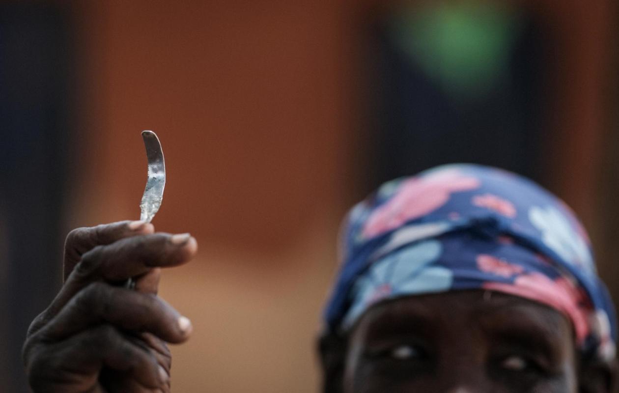 Guinée : Une fillette de 5 ans décède des suites d’une excision à Koloma