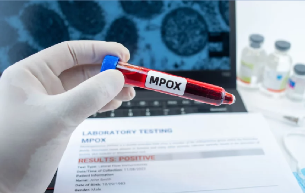 Mode de transmission, signes et mesures préventives : ce qu’il faut savoir sur le Mpox