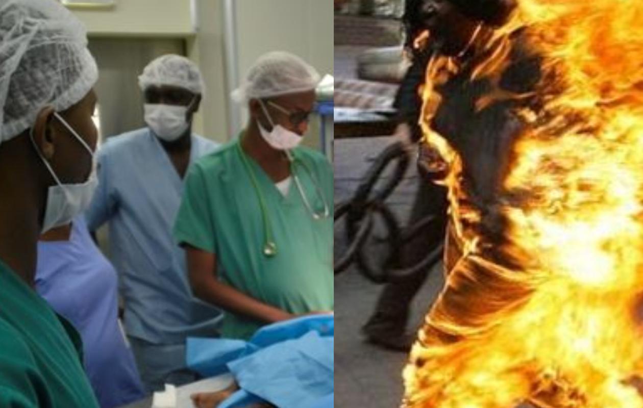 Ziguinchor : Des nouvelles de Khady, la fillette brûlée par son père