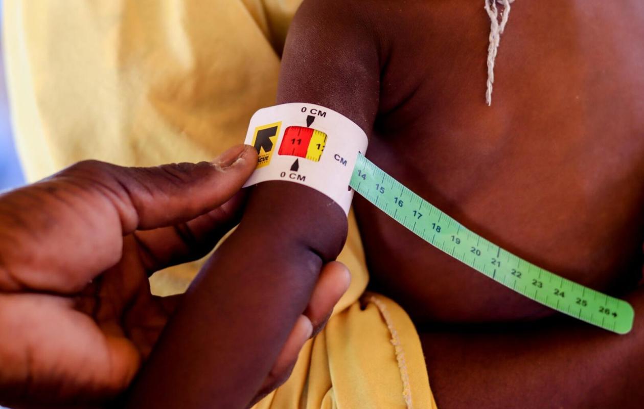 [Dossier 2/6] Malnutrition à Diourbel : L’abandon des traitements encore préoccupant