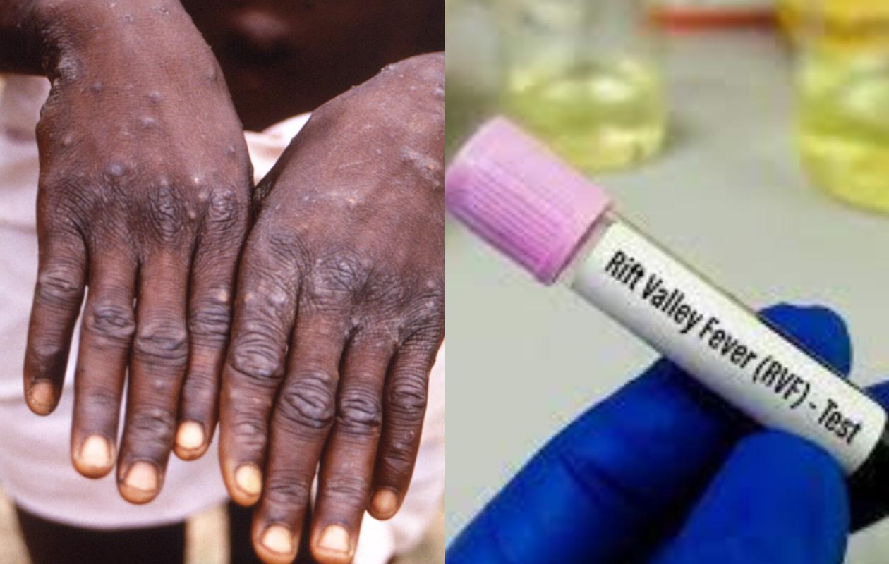 Epidémies : la fièvre de la vallée du Rift monte à 90 cas, le Mpox contenu