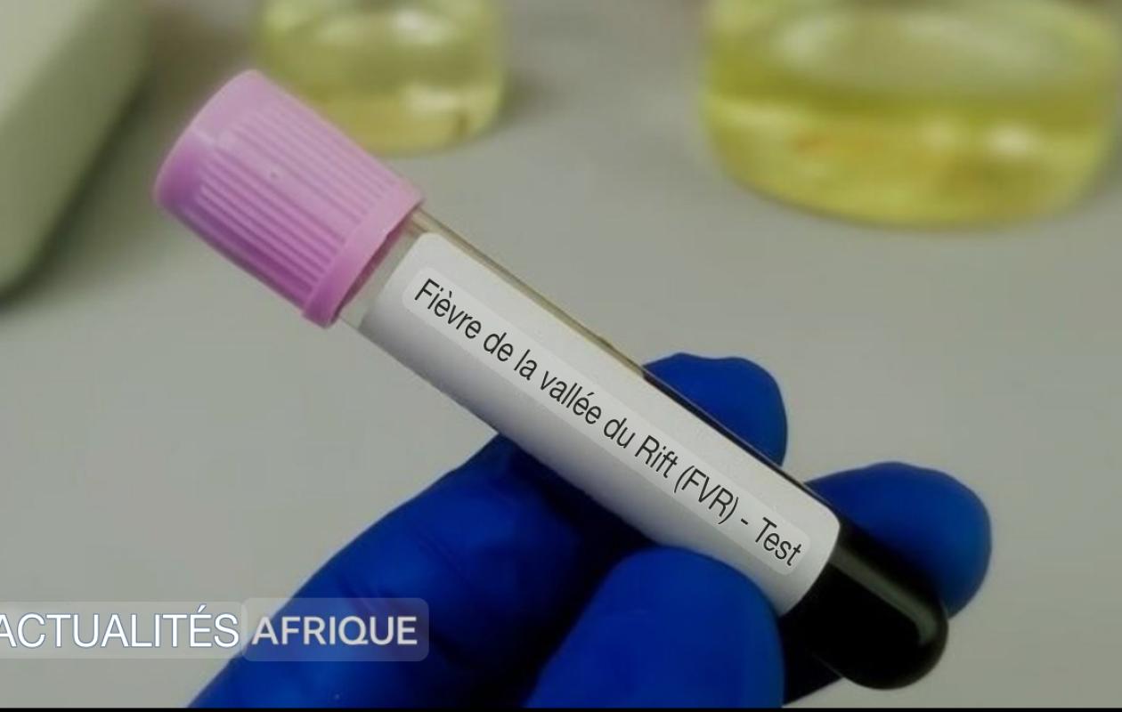 Épidémies de Fièvre de la Vallée du Rift et de Mpox : Le ministère de la Santé dresse un nouveau bilan