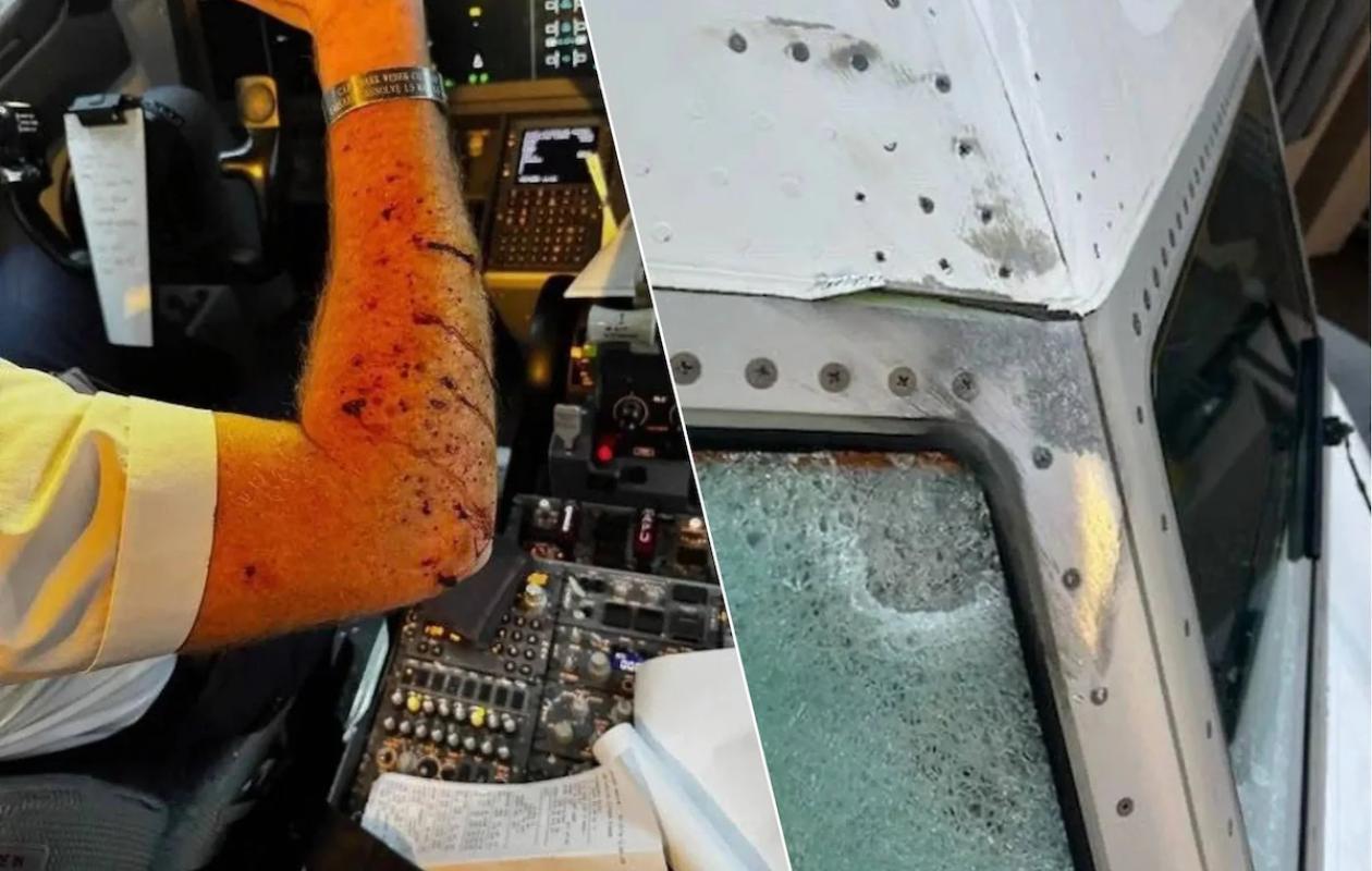 Un objet non identifié brise la vitre du cockpit: un pilote de United Airlines blessé en plein vol
