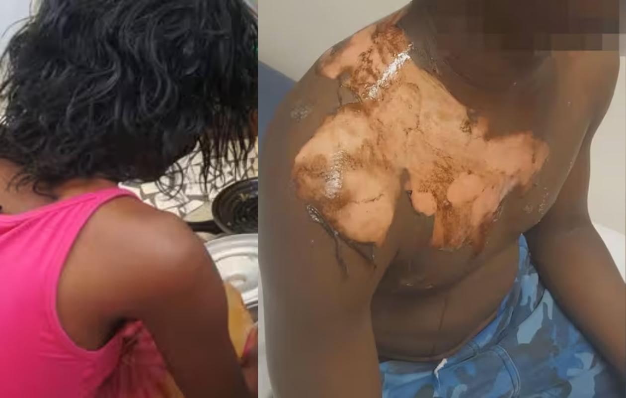 Thiès : Le verdict est tombé pour la femme qui avait ébouillanté son mari