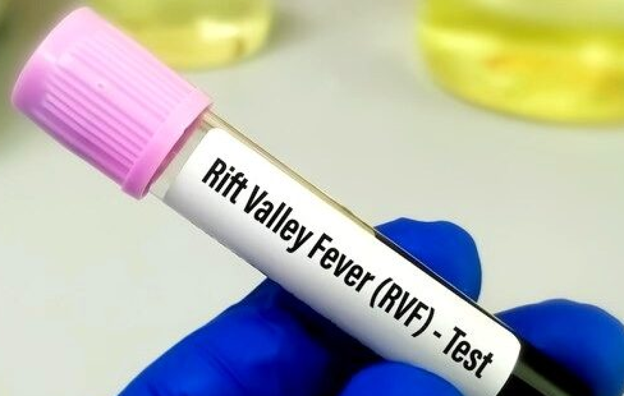 KAOLACK : LES ACTEURS FORMES A LA GESTION DE L'INFODEMIE