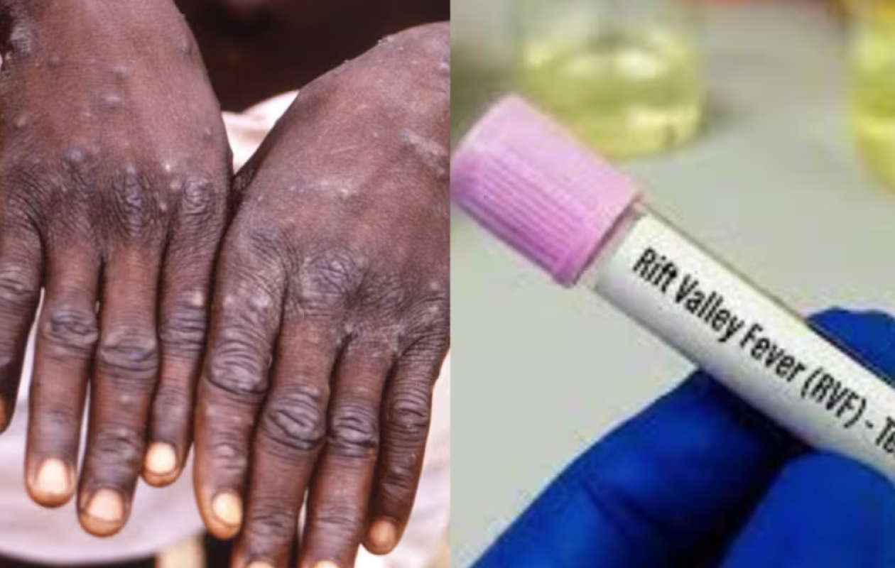 Épidémies Mpox et FVR : Les derniers chiffres