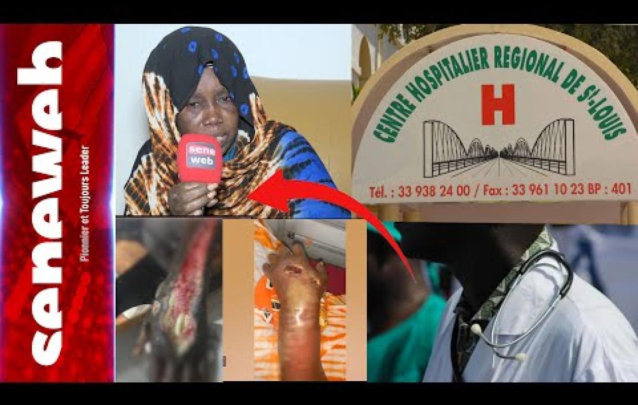 Hôpital de Saint-Louis : Un scanner rate, Fatou Wellé risque de perdre sa main