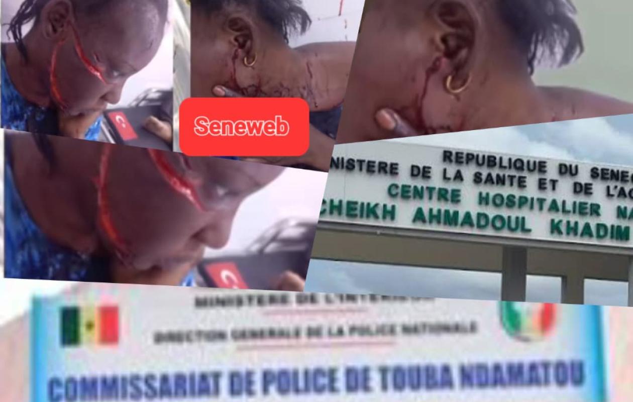 Horreur à Touba : Une infirmière d'État lacère le visage de sa coépouse, un médecin de Cheikhoul Khadim risque gros