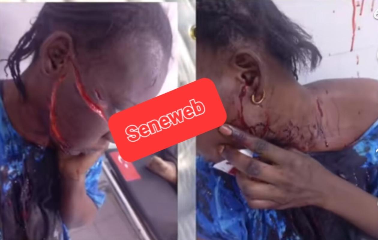 Femme lacérée à Touba : Sa coépouse infirmière d'État envoyée à la prison de Diourbel