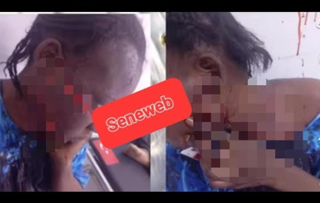 Femme lacérée à Touba : Sa coépouse infirmière d'État condamnée à 2 mois ferme