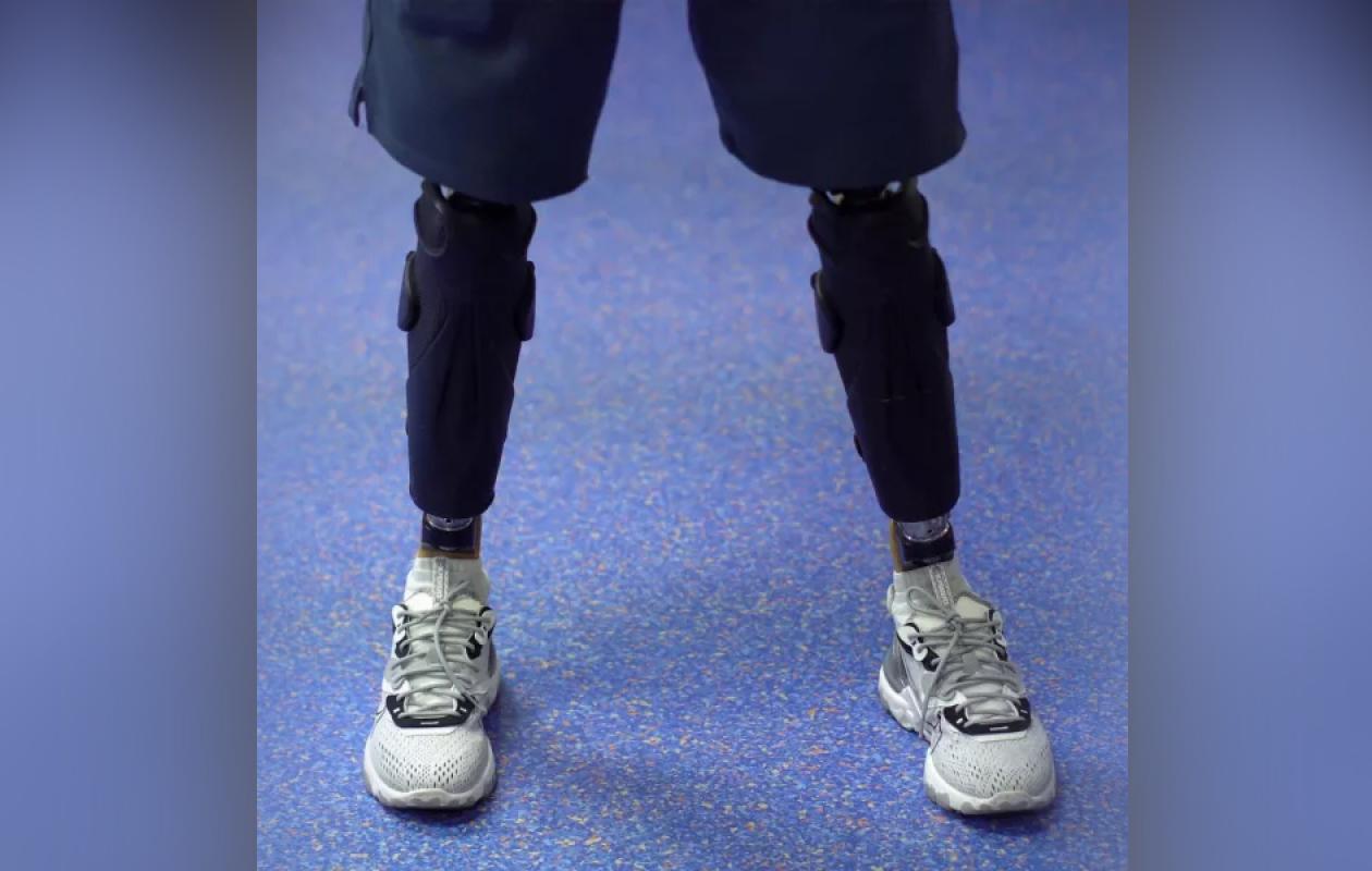 « Je ne réclame rien » : la victime, amputée des deux jambes après un accident, pardonne à...