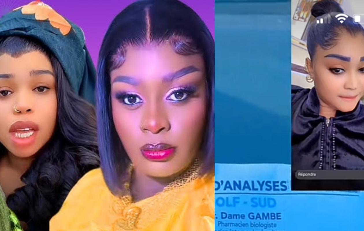 VIH Sida : Face à la rumeur, ces célébrités du showbiz qui affichent leurs tests de dépistage