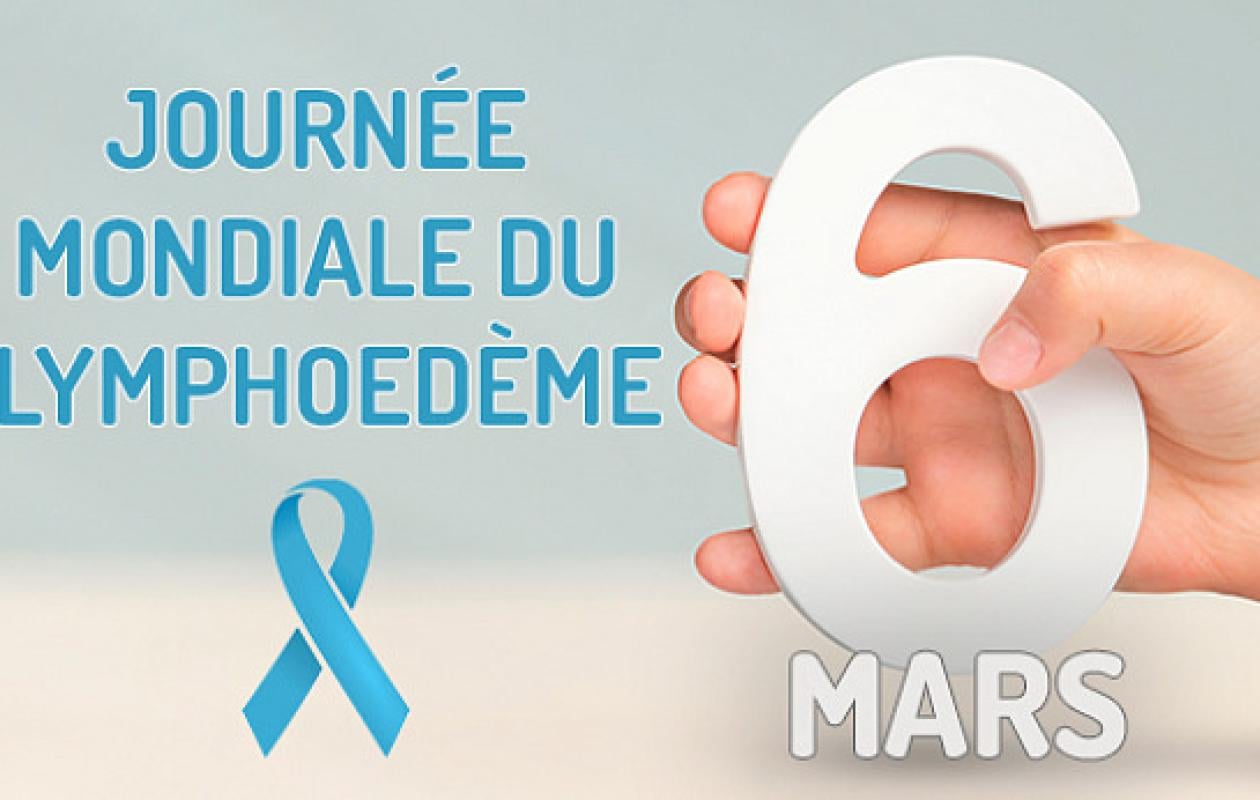 Journée mondiale du lymphœdème : Plaidoyer pour une meilleure prise en charge au Sénégal