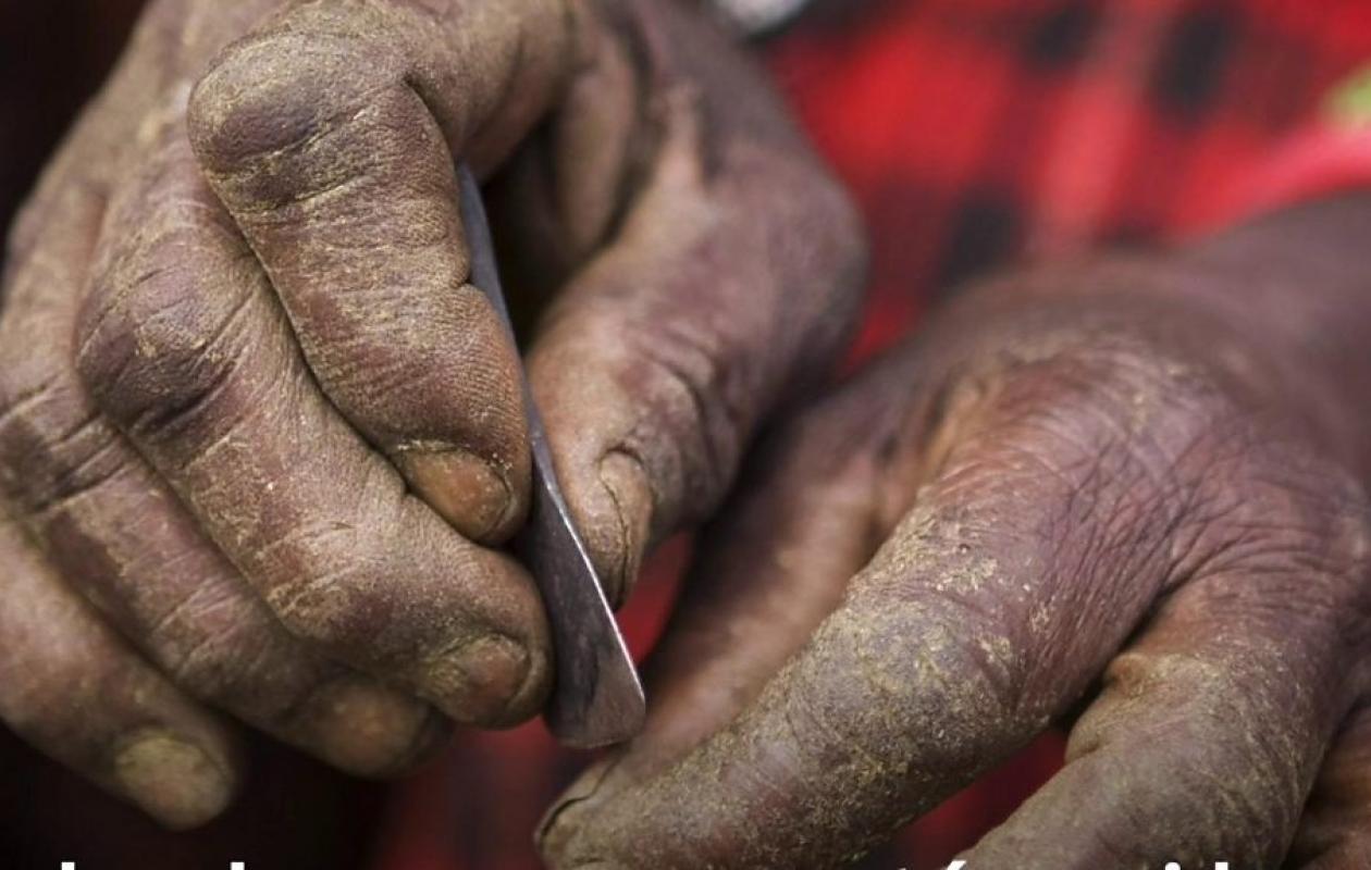 CORPS MUTILES, DROITS BAFOUES : Ces voix qui se lèvent pour briser la tradition de l'excision