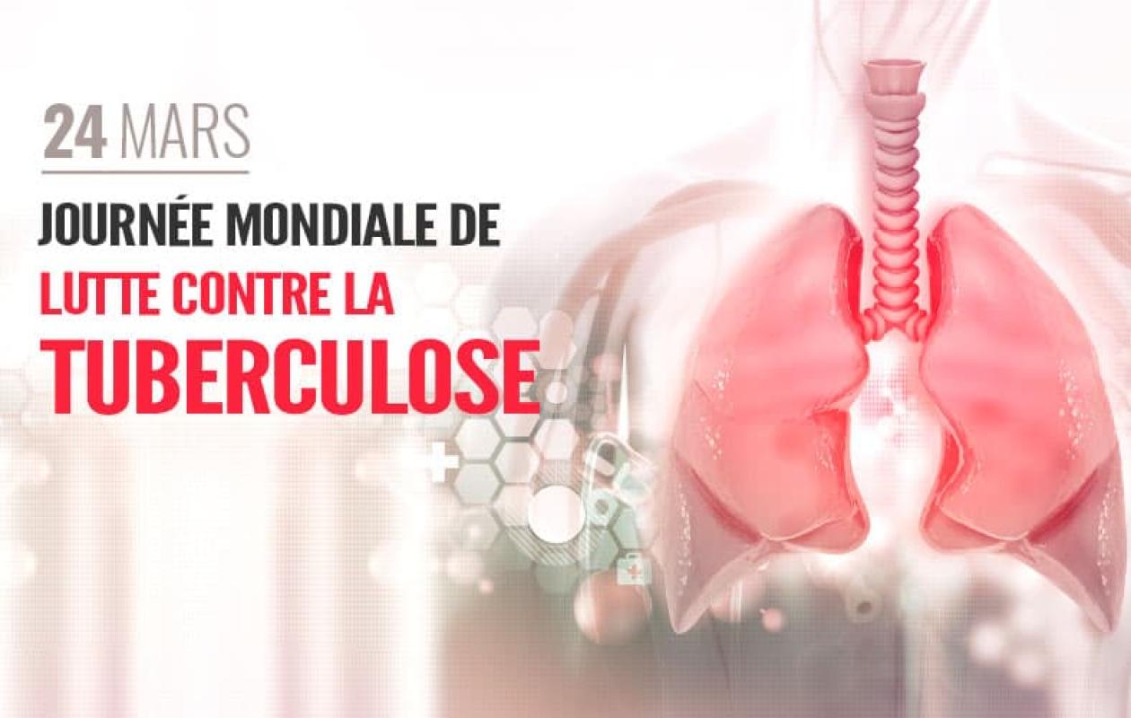 Prise en charge équitable de la tuberculose : L’urgence de corriger les dysfonctionnements au Sénégal