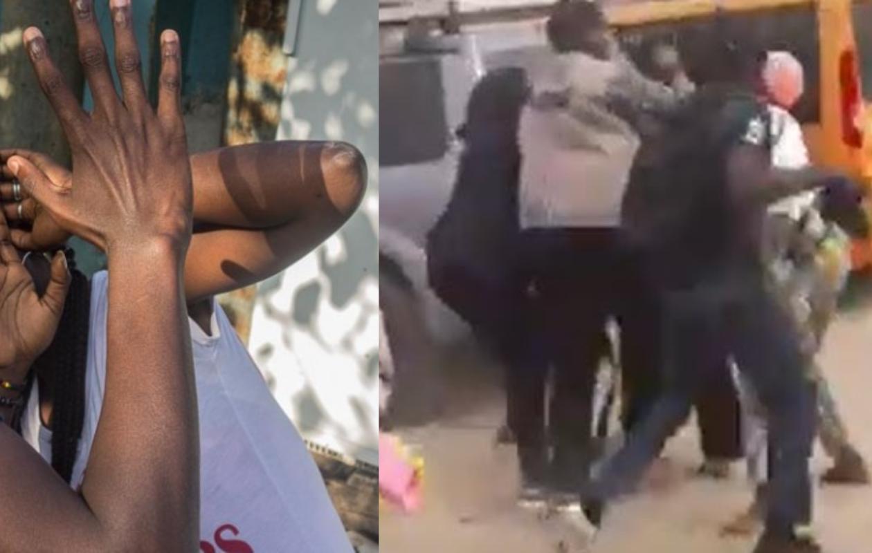 « Elle a saisi mes parties intimes » : Un homme frappe sa belle-sœur et invoque une défense insolite