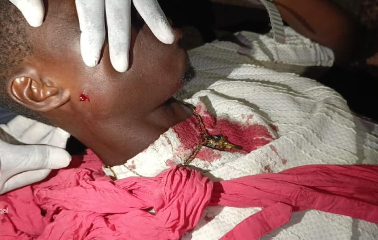 Sédhiou : Un étudiant sauvagement agressé, son engin emporté