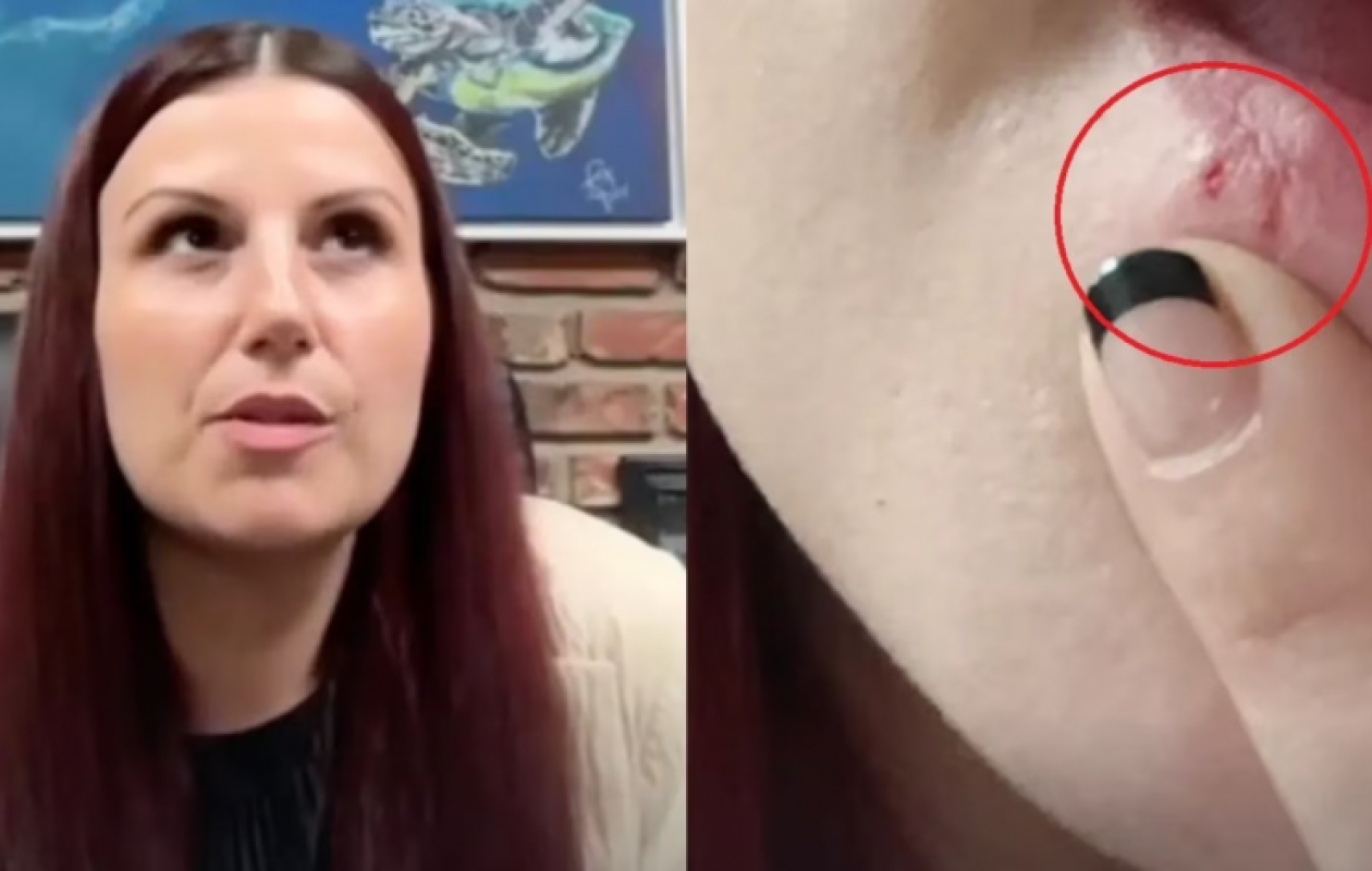 Une restauratrie accusée d’avoir craché dans un plat et transmis l’herpès à une cliente