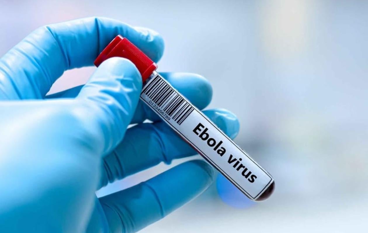 Alerte sanitaire : Un premier cas d’Ebola détecté en France chez un médecin de retour de RDC