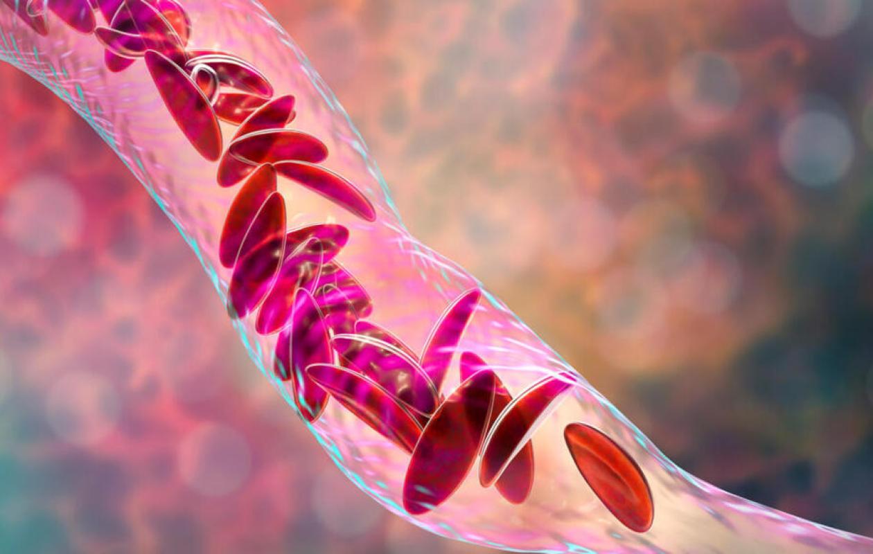 UCAD : Une innovation du Pr Mor Diaw pourrait transformer le diagnostic de la drépanocytose