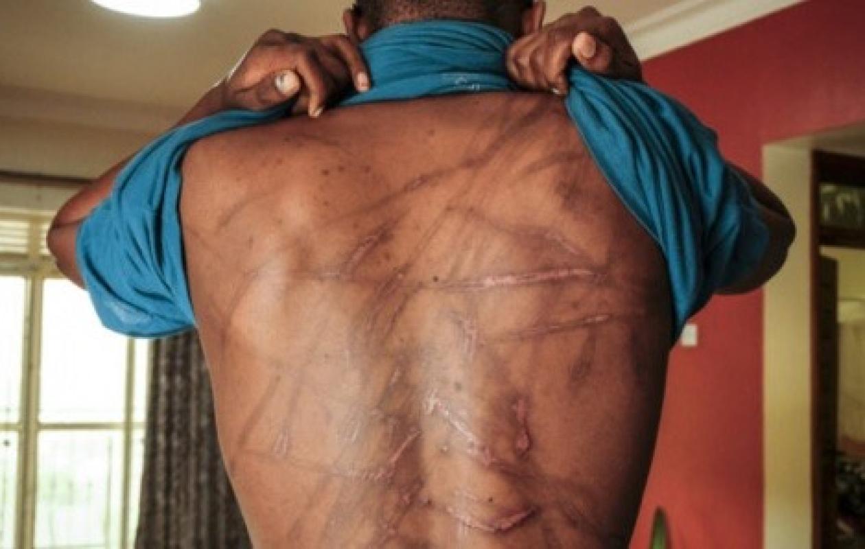 WAKHINANE NIMZATT : un voleur lynché, blessé, puis conduit à la police
