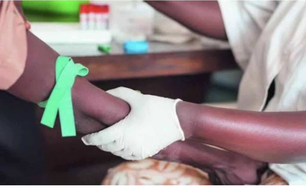 Kolda : après l'annonce de sa séropositivité, un homme hospitalisé dans un état grave